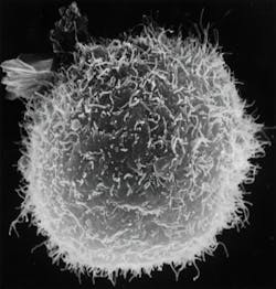 Macrophage Photo By National Cancer Institute On Unsplash 61771bcfe181a Macrophage Photo By National Cancer Institute On Unsplash 61771bcfe181a