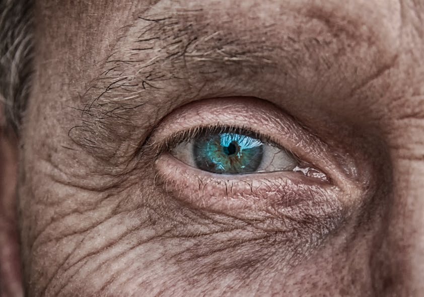 Man Eye Image By Analogicus From Pixabay