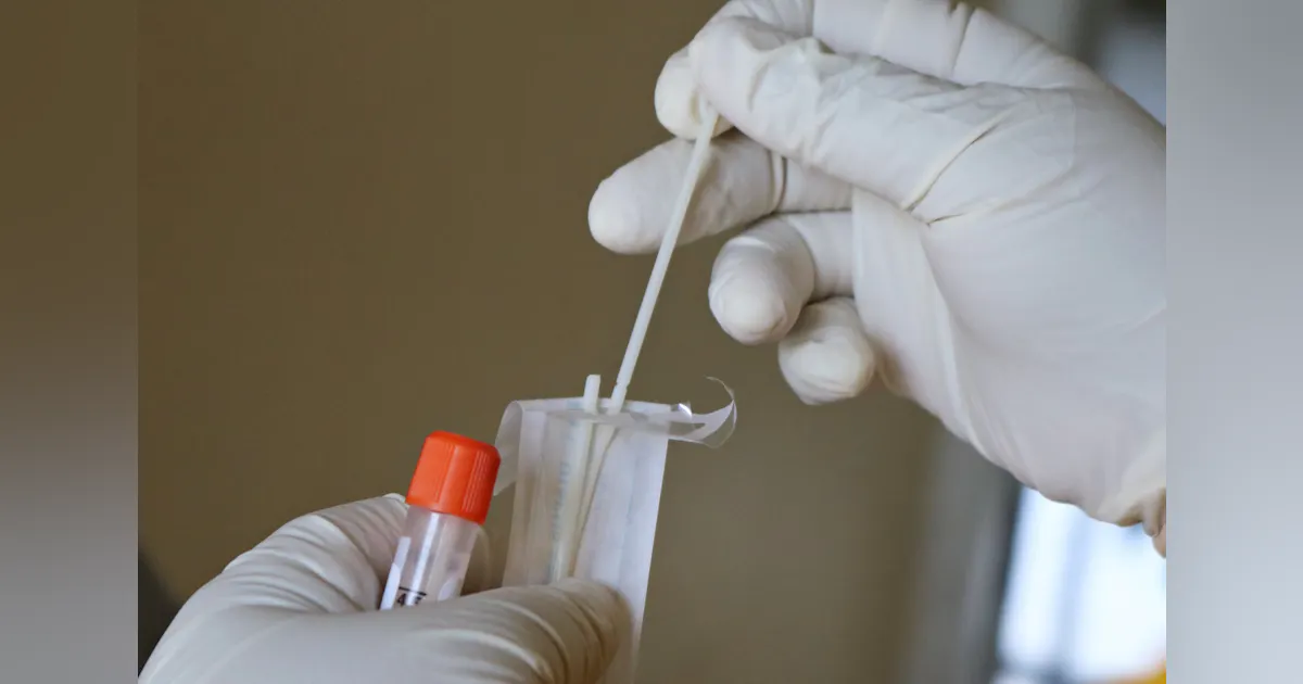 Abbott’s Alinity SARS-CoV-2 tests recalled | Medical Laboratory Observer
