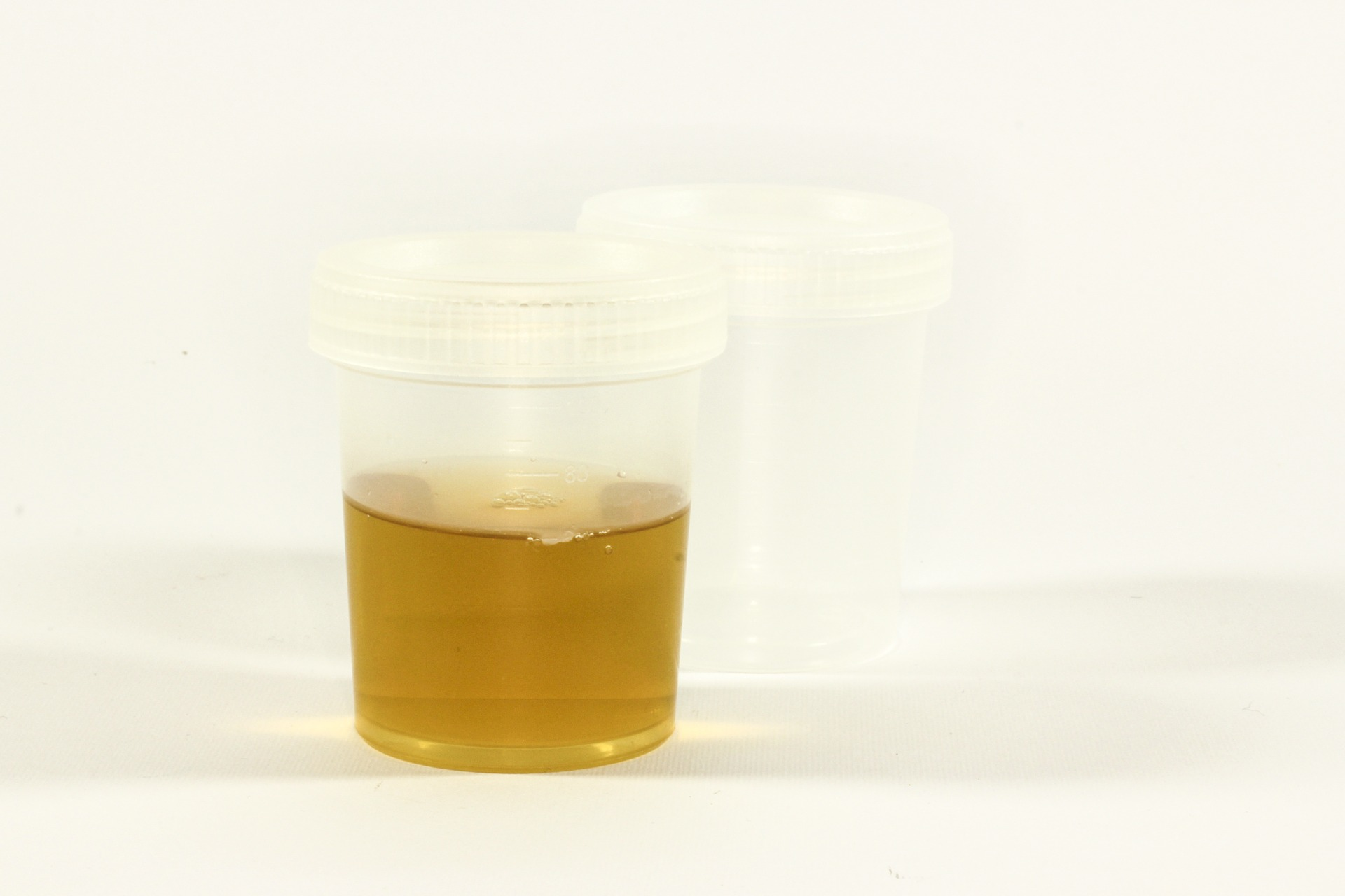Urine Sample Image By Ewa Urban From Pixabay 61769eafd7952