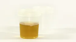 Urine Sample Image By Ewa Urban From Pixabay