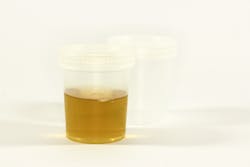 Urine Sample Image By Ewa Urban From Pixabay 61769eafd7952 Urine Sample Image By Ewa Urban From Pixabay 61769eafd7952