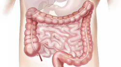 Offal G6cf7c4d79 1280