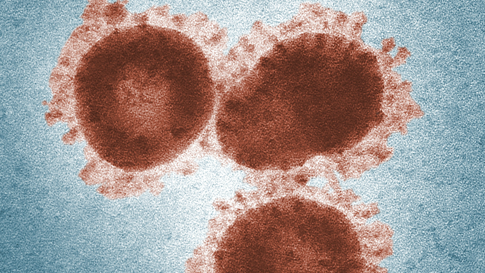 Pexels Cdc 3992945 618d233ec3dd3