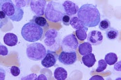 Courtesy of CDC Courtesy of CDC