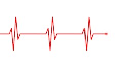 Alzheimers Image By Gerd Altmann From Pixabay 618e6e9dca59c Alzheimers Image By Gerd Altmann From Pixabay 618e6e9dca59c