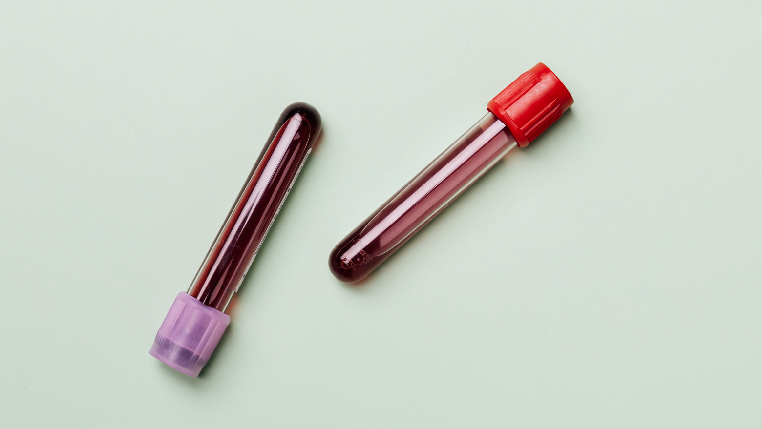 Pexels Karolina Grabowska 4047146 1 61a8e3c80229d