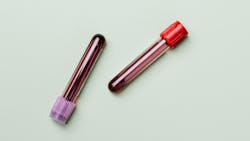 Pexels Karolina Grabowska 4047146 1 61a8e3c80229d Pexels Karolina Grabowska 4047146 1 61a8e3c80229d