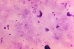 22817 61af8d2ea785a 22817 61af8d2ea785a