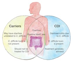 Figure 1. Distinguishing between carriers of C. difficile and patients with CDI can be challenging