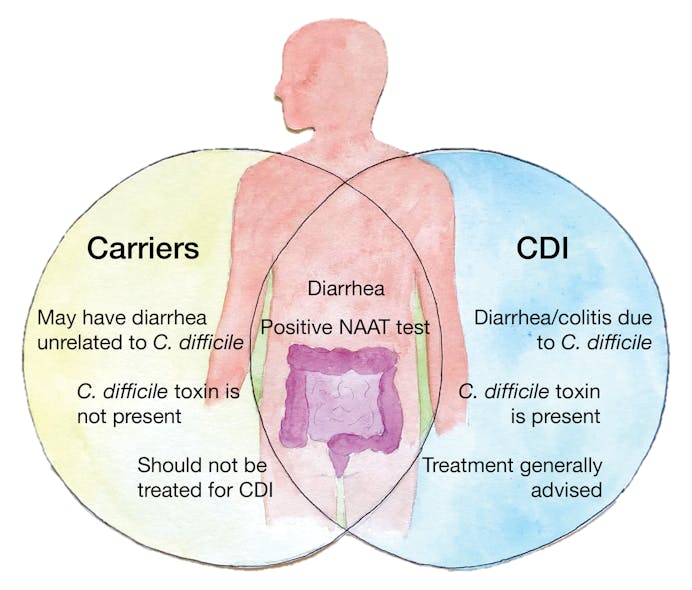 Figure 1. Distinguishing between carriers of C. difficile and patients with CDI can be challenging