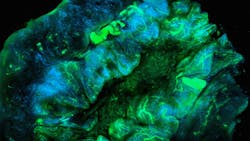 Unsplash Ovarian Cancer Cells National Cancer Institute A6 Mf Mn Q3ow Unsplash 1 61e1da2f28814 Unsplash Ovarian Cancer Cells National Cancer Institute A6 Mf Mn Q3ow Unsplash 1 61e1da2f28814