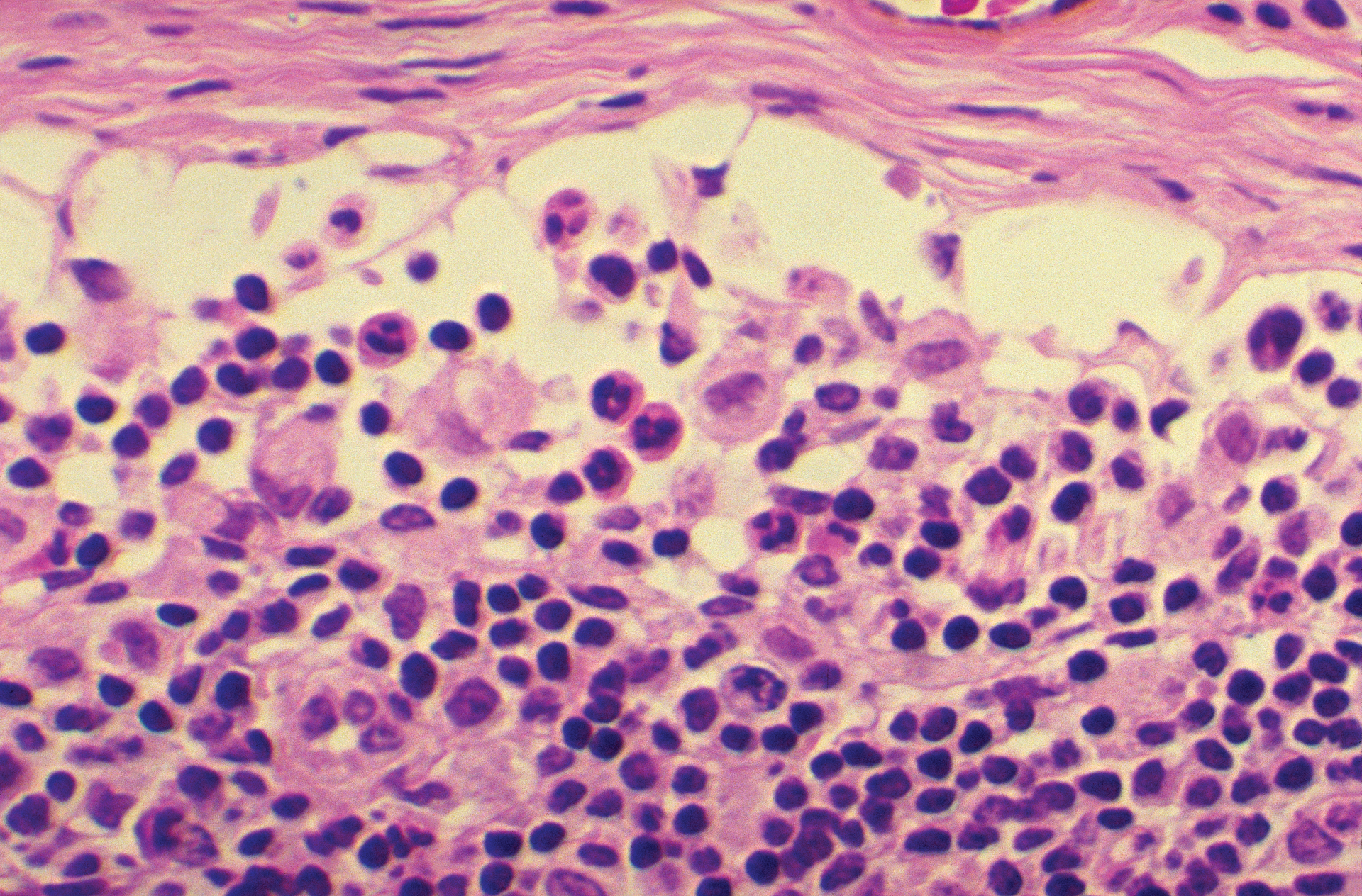 Cdc Hiv 61e06be5769a3