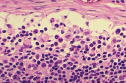 Cdc Hiv 61e06be5769a3 Cdc Hiv 61e06be5769a3