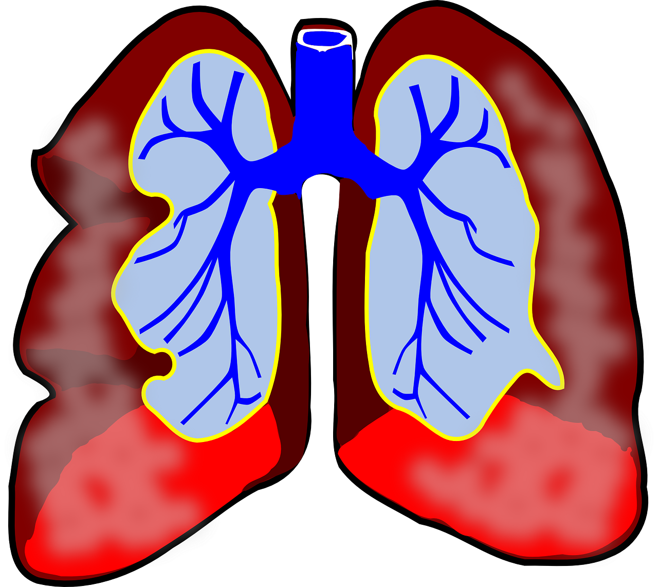 Pixabay Lungs G9e5c4ea28 1280 61f15a8720aae