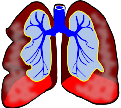 Pixabay Lungs G9e5c4ea28 1280 61f15a8720aae Pixabay Lungs G9e5c4ea28 1280 61f15a8720aae