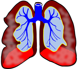 Pixabay Lungs G9e5c4ea28 1280