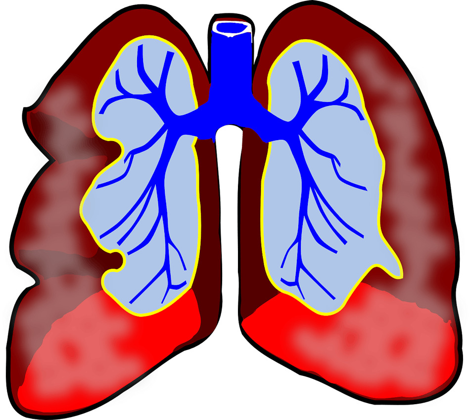 Pixabay Lungs G9e5c4ea28 1280