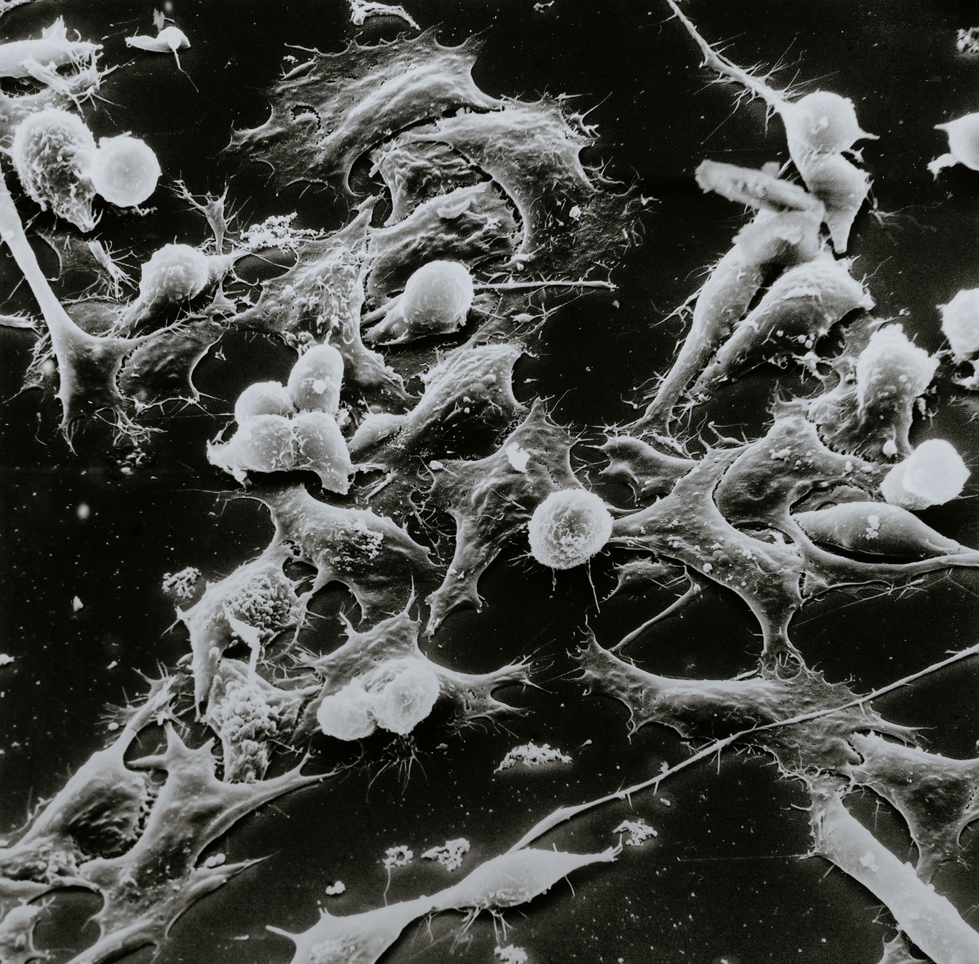 Unsplash Cancer Cells National Cancer Institute W Ug8xh J3a Bs Unsplash 1 61ead0b0572bc