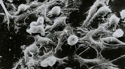 Unsplash Cancer Cells National Cancer Institute W Ug8xh J3a Bs Unsplash (1)