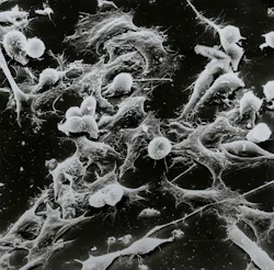 Unsplash Cancer Cells National Cancer Institute W Ug8xh J3a Bs Unsplash 1 61ead0b0572bc Unsplash Cancer Cells National Cancer Institute W Ug8xh J3a Bs Unsplash 1 61ead0b0572bc