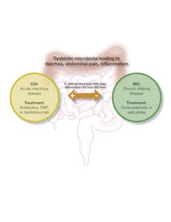 Figure 1. CDI and IBD are two unrelated diseases that are triggered by a dysbiotic intestinal microbiota. The use of a stool toxin test can help identify CDI in a patient with IBD, resulting in appropriate therapy for the infection.