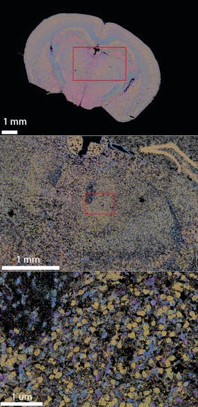 Figure 1. A full mouse brain coronal slice undergoes massively multiplexed single-molecule imaging technology measurement: Massively multiplexed single-molecule imaging technology measurements capture information about target genes of different colors with subcellular resolution. The data may be viewed as a whole (top), zoomed in to observe patterns across neighboring cell populations (center), or zoomed in to view transcripts within individual cells.