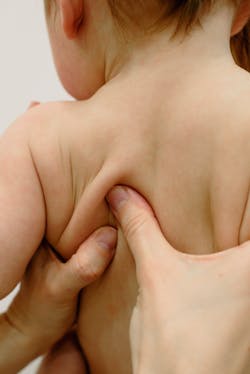 Pexels Scoliosis Pexels Ksenia Chernaya 6670993 6218f00aa9f98 Pexels Scoliosis Pexels Ksenia Chernaya 6670993 6218f00aa9f98