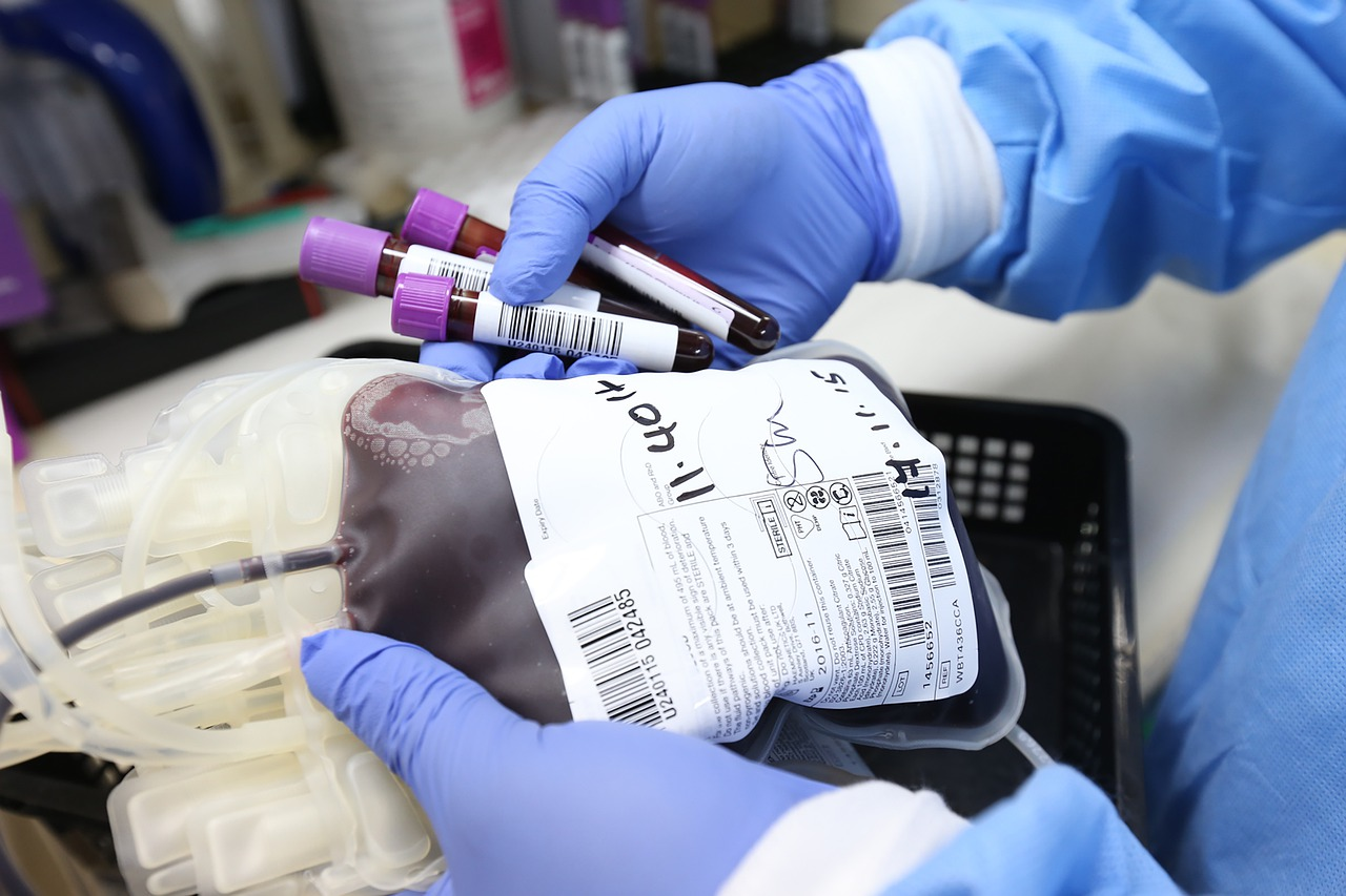 Pixabay Blood Gd7a8b5930 1280 6203ce3ce9706