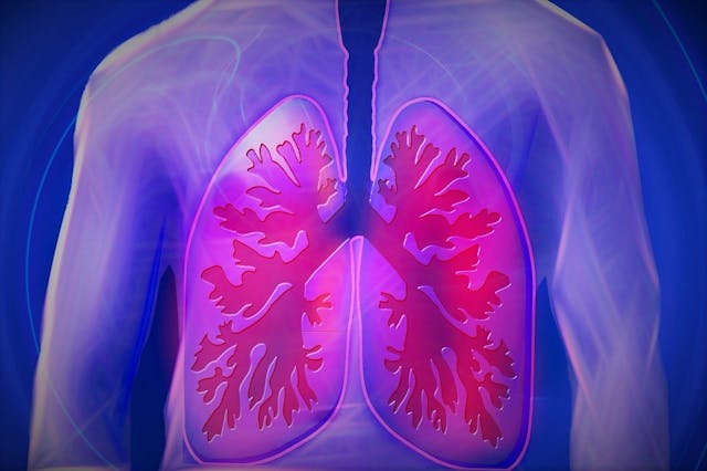 Pixabay Lungs Upper Body G823b8e7d2 1280