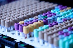 Testalize Me 0j E8yn V4mis Unsplash 6213b3c9a216b Testalize Me 0j E8yn V4mis Unsplash 6213b3c9a216b