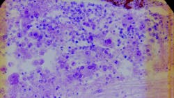 Courtesy of the CDC Courtesy of the CDC