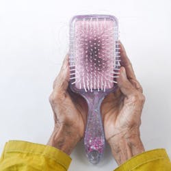 Unsplash Alopecia Towfiqu Barbhuiya Te X Sl0 O Nrdk Unsplash 6245b9e095800 Unsplash Alopecia Towfiqu Barbhuiya Te X Sl0 O Nrdk Unsplash 6245b9e095800