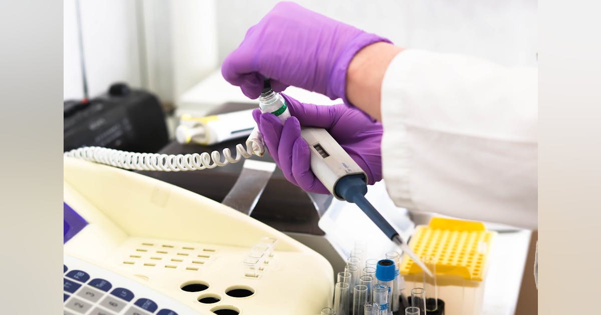 Researchers develop new MS antibody test | Medical Laboratory Observer