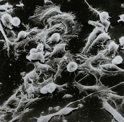 Unsplash Cancer National Cancer Institute W Ug8xh J3a Bs Unsplash 6234841a1cb92 Unsplash Cancer National Cancer Institute W Ug8xh J3a Bs Unsplash 6234841a1cb92