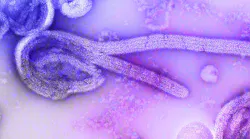 Unsplash Ebola Cdc 7 Cqfc Ho Fl O Unsplash