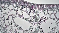 Unsplash Fatty Tissue Fayette Reynolds V Y Ve Ngv Fr Tc Unsplash 6239d3a55997a Unsplash Fatty Tissue Fayette Reynolds V Y Ve Ngv Fr Tc Unsplash 6239d3a55997a