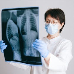 Pexals Lungs Pexels Anna Shvets 4225880 624c435fe82a4 Pexals Lungs Pexels Anna Shvets 4225880 624c435fe82a4