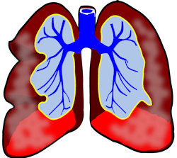 Pixabay Lungs G9e5c4ea28 1280 624db81c1e2f7 Pixabay Lungs G9e5c4ea28 1280 624db81c1e2f7