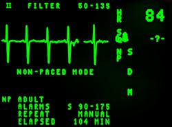 Pixabay Heart Rhythm Electrocardiogram G939dab367 1920 62583320b07cd Pixabay Heart Rhythm Electrocardiogram G939dab367 1920 62583320b07cd