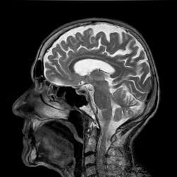 Pixabay Mri G3ce0afdfa 1920 62598bd5d2c6a Pixabay Mri G3ce0afdfa 1920 62598bd5d2c6a