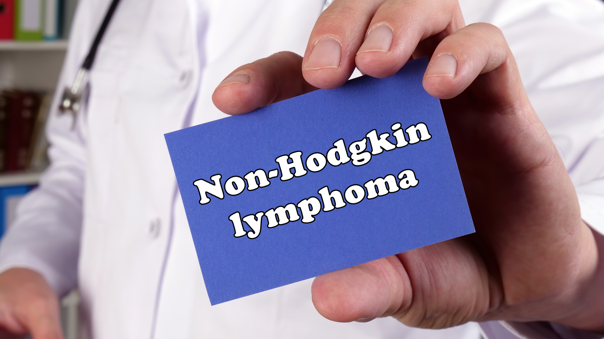 Adobe Non Hodgkins Adobe Stock 404208778 62825dfc08a81