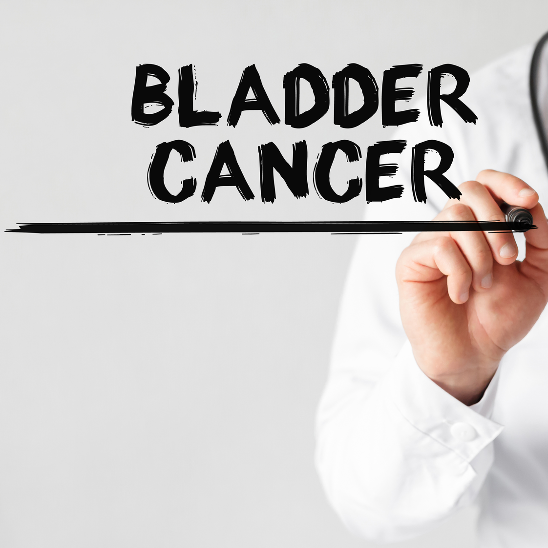 Adobe Bladder Cancer Adobe Stock 179549852 628508e87b300