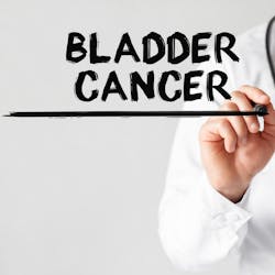 Adobe Bladder Cancer Adobe Stock 179549852 628508e87b300 Adobe Bladder Cancer Adobe Stock 179549852 628508e87b300