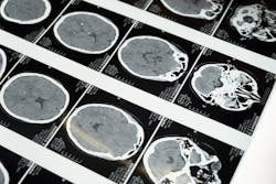 Pexels Brain Mri Pexels Cottonbro 5723883 1 6279275805be6 Pexels Brain Mri Pexels Cottonbro 5723883 1 6279275805be6