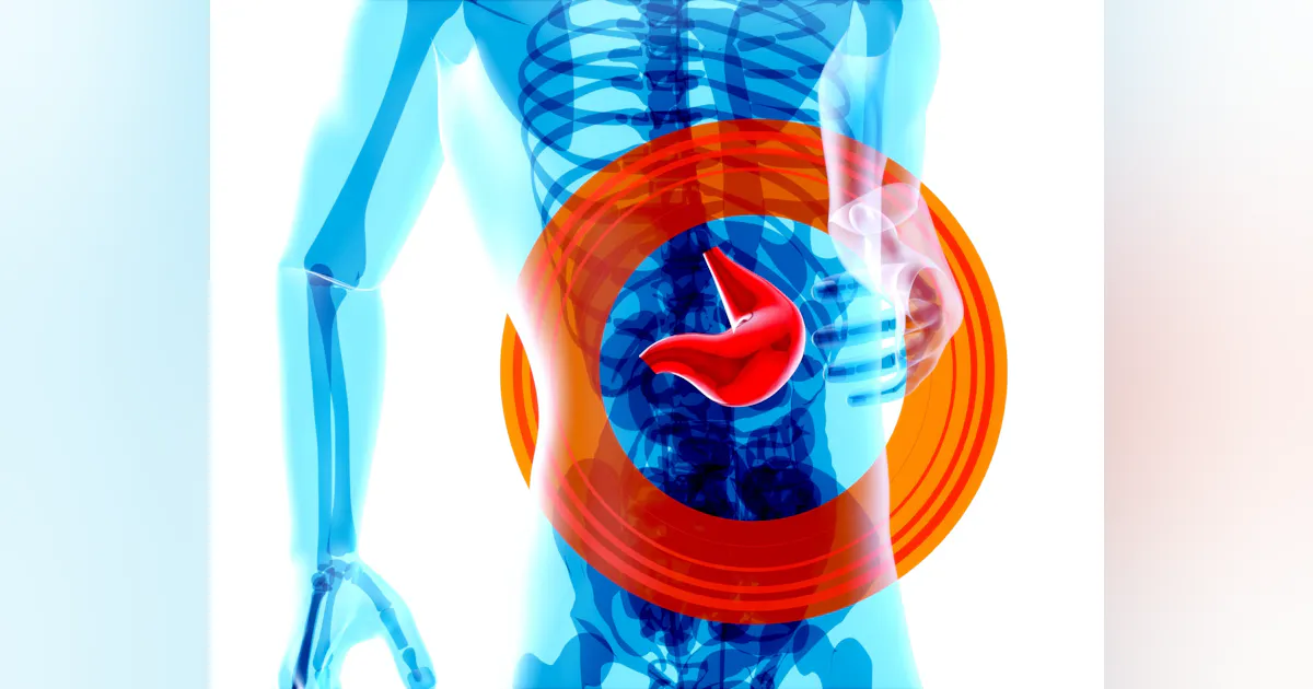 Microbiome “fingerprint” method tracks sub-strain variants of a single ...