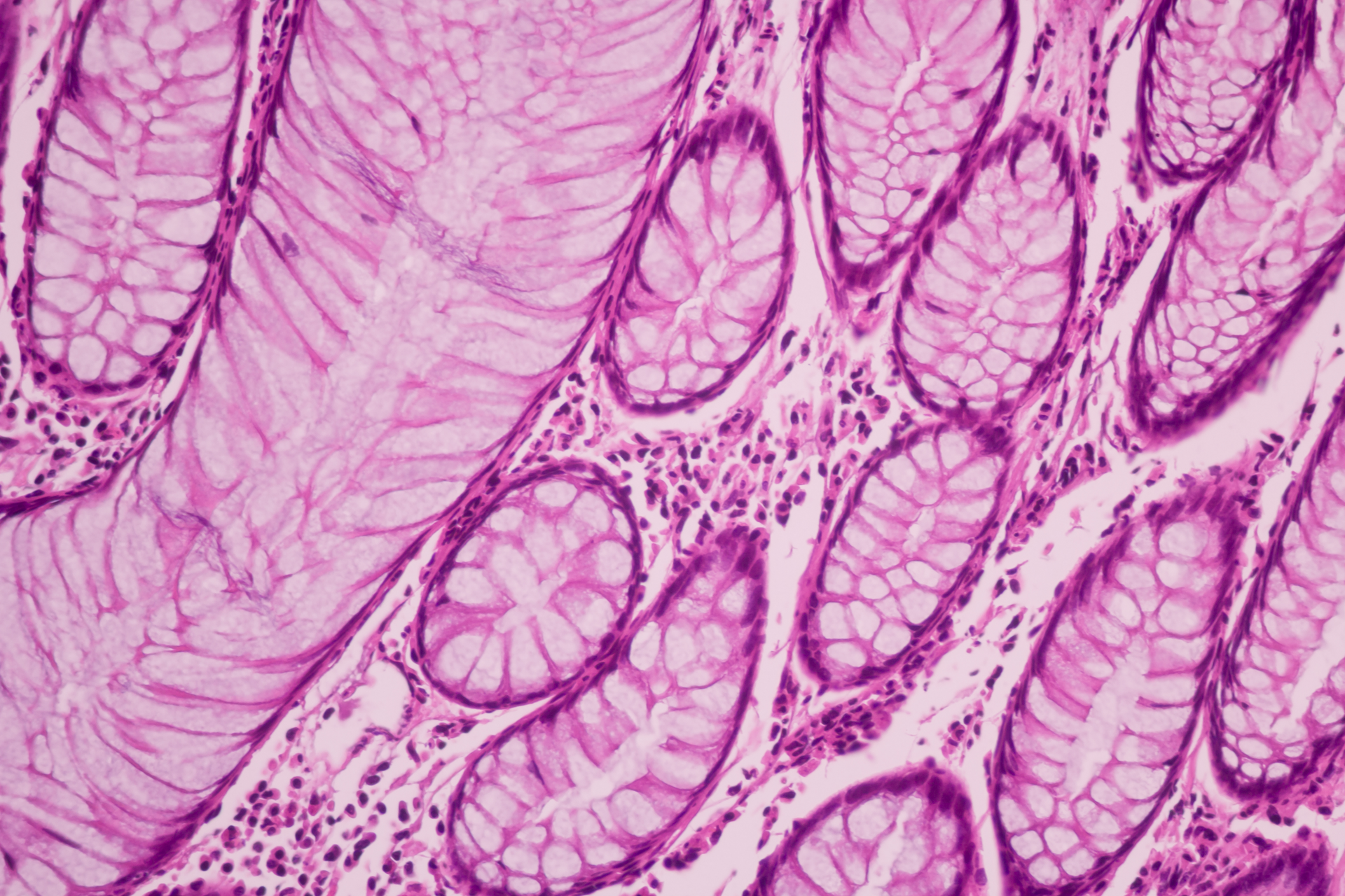 Adobe Cancer Adobe Stock 320367315 62b328066cf1c