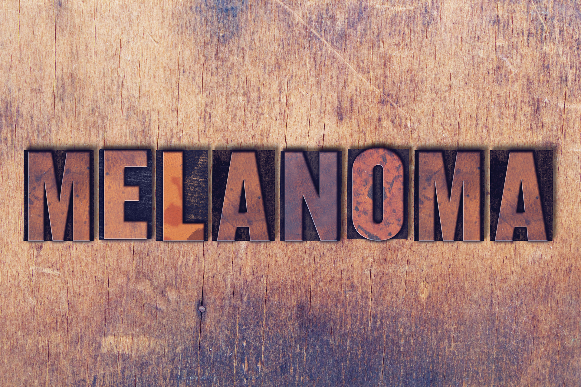 Adobe Melanoma Adobe Stock 164746430 62ac984a97f34