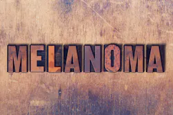 Adobe Melanoma Adobe Stock 164746430 62ac984a97f34 Adobe Melanoma Adobe Stock 164746430 62ac984a97f34