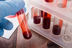 Adobe Testing Adobe Stock 103155985 62b9e04ca6e70 Adobe Testing Adobe Stock 103155985 62b9e04ca6e70